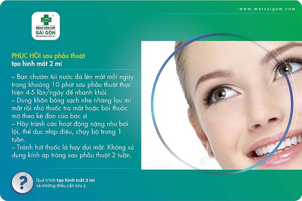 tạo hình mắt 2 mí