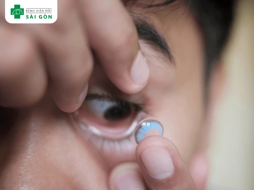 Các bước tháo kính áp tròng