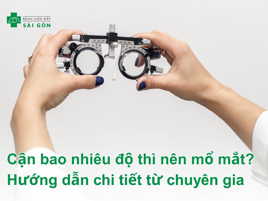 Cận bao nhiêu độ thì nên mổ mắt?