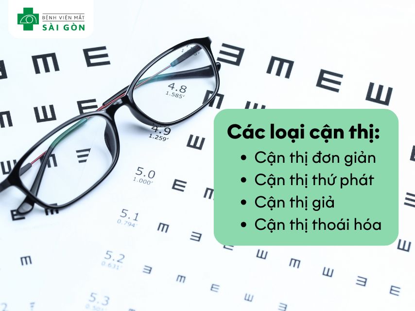 Tìm hiểu 4 loại cận thị