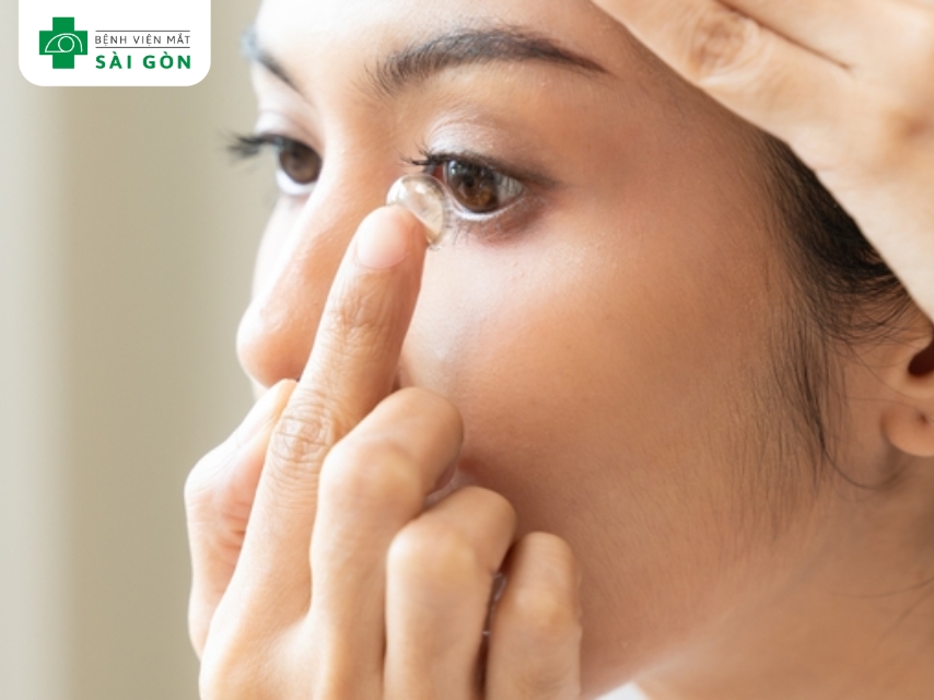 Trường hợp không nên đeo kính áp tròng theo nhãn khoa