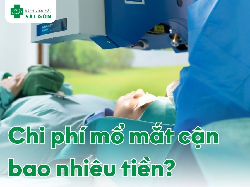 Chi phí mổ mắt cận thị mới nhất