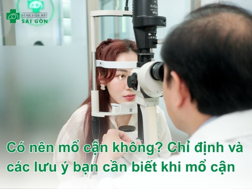 Có nên mổ cận không? Các chỉ định cần biết