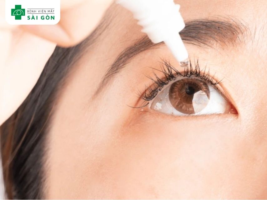 Thuốc nhỏ mắt hỗ trợ trị bệnh lý nhãn khoa