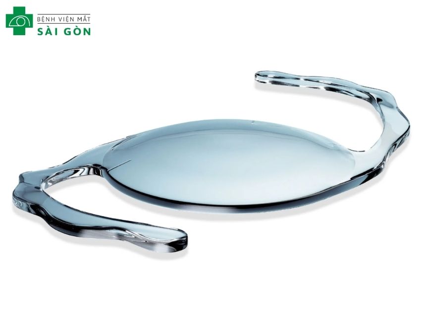 Phương pháp phẫu thuật mắt cận đặt kính hội nhãn