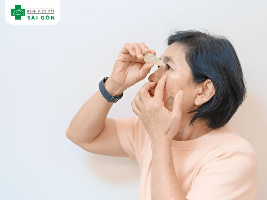 Dùng nước mắt nhân tạo rửa sạch ghèn mắt