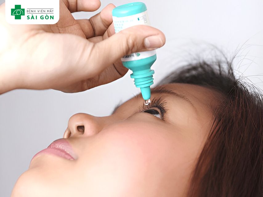 Sử dụng thuốc nhỏ mắt theo chỉ định bác sĩ