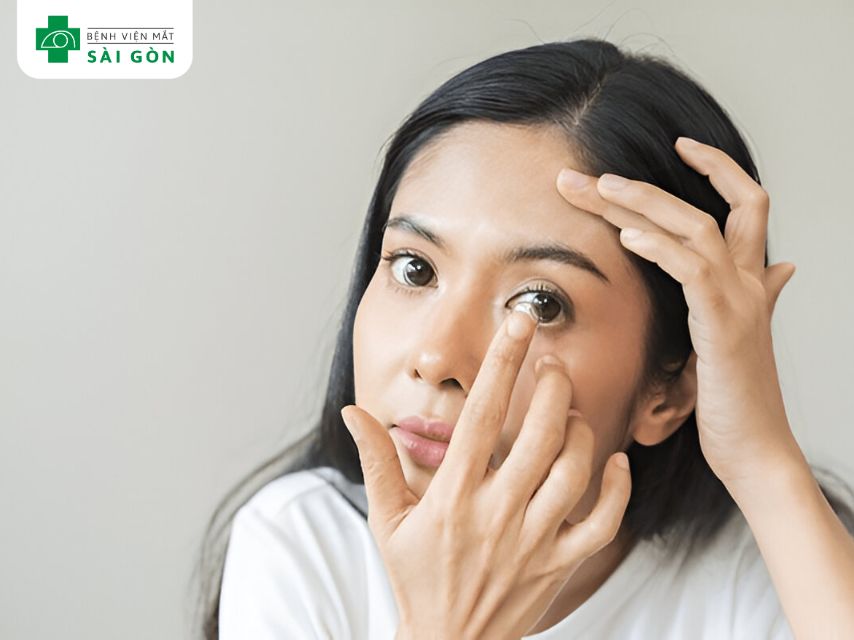 Đeo kính áp tròng không vệ sinh gây đổ ghèn