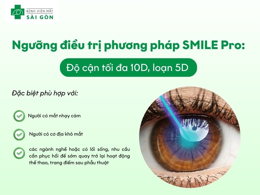 Đối tượng phẫu thuật SMILE Pro