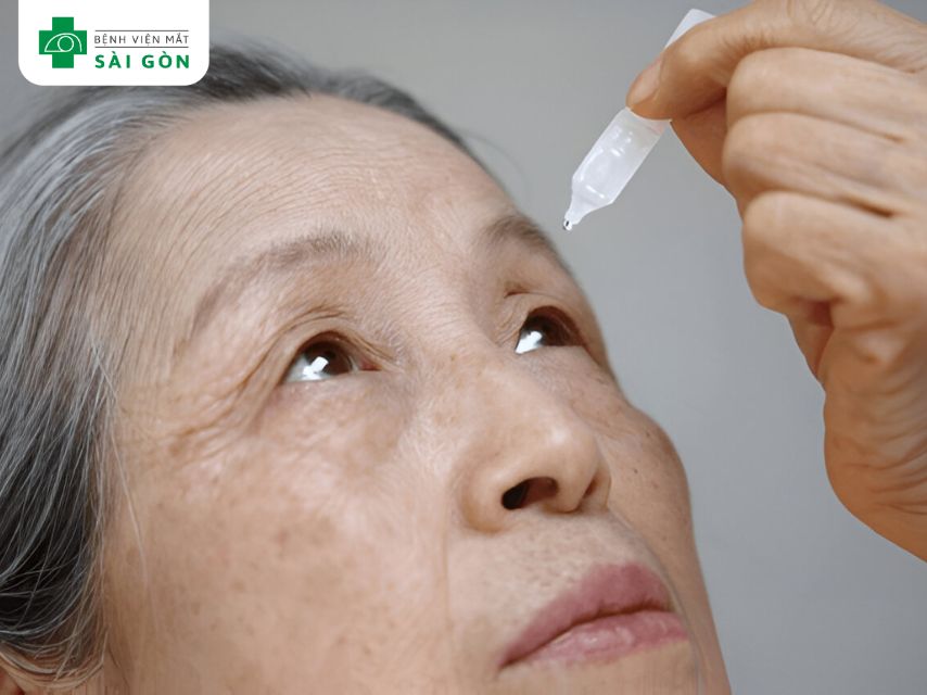 Hội chứng khô mắt gây chảy nước mắt sống người cao tuổi