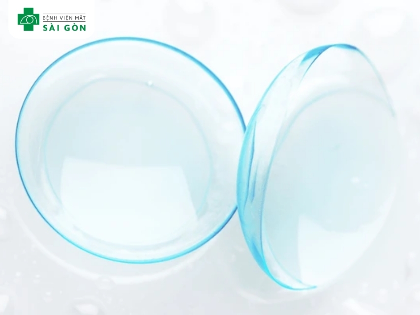 Khái niệm kính áp tròng