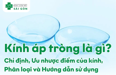 Nhận biết kính áp tròng và các thông tin nên biết