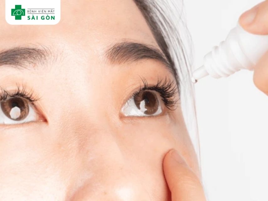 Nước mắt nhân tạo chăm sóc sức khỏe đôi mắt