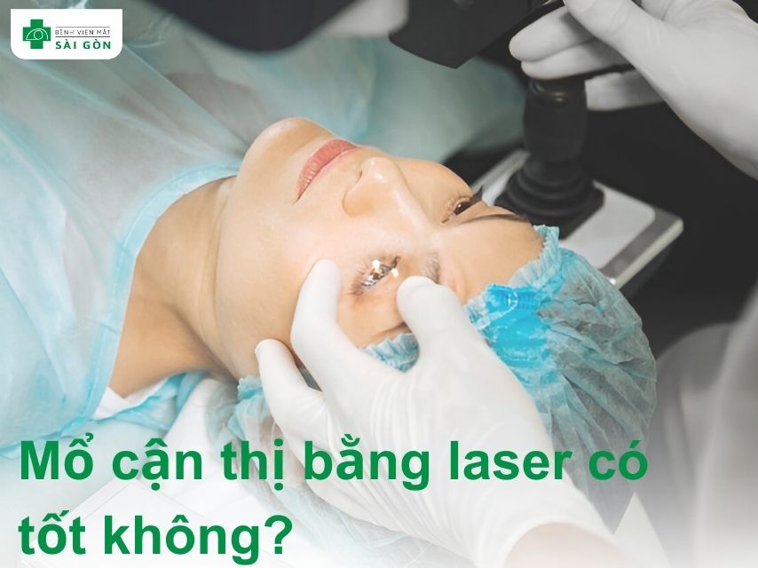 Mổ cận bằng laser là phương pháp an toàn an toàn