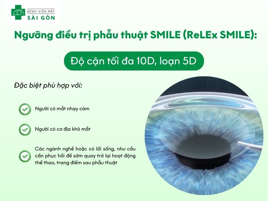 SMILE cận tối đa 10D