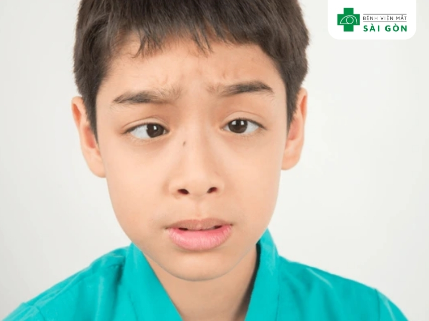 Di truyền là một trong các nguyên nhân gây mắt lác