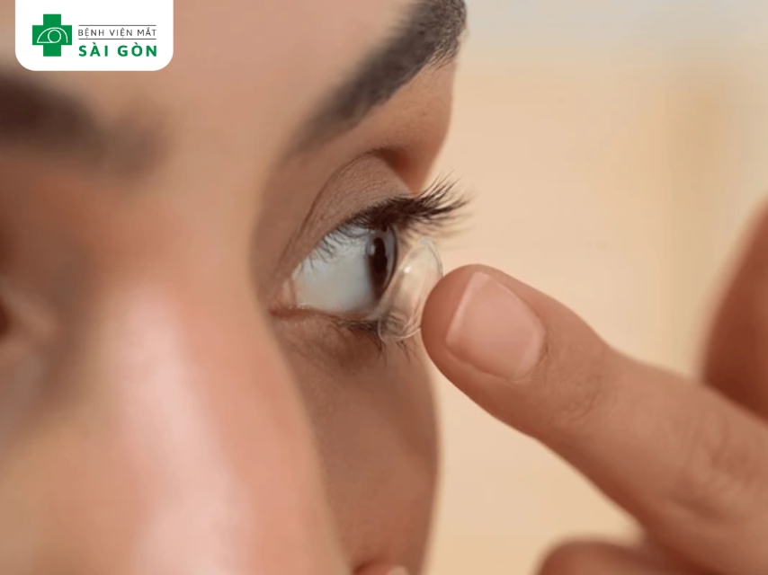 Phân loại kính áp tròng theo chức năng sử dụng