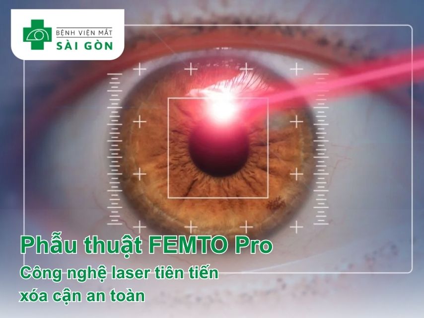 Phẫu thuật khúc xạ FEMTO Pro