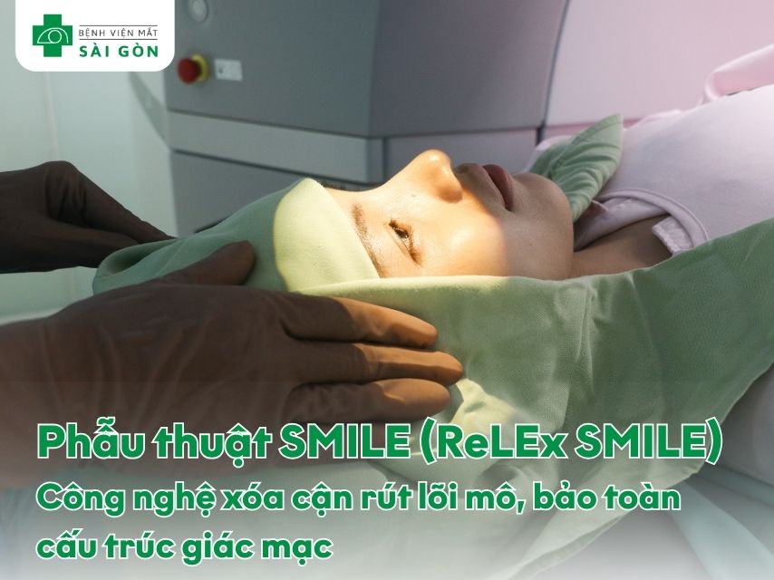 Mổ cận bằng phương pháp SMILE