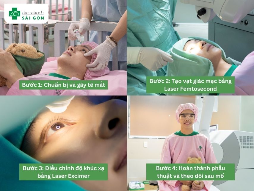 Quy trình phẫu thuật FEMTO tại Mắt Sài Gòn