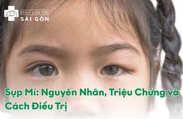 Tổng quan chung về bệnh sụp mí mắt