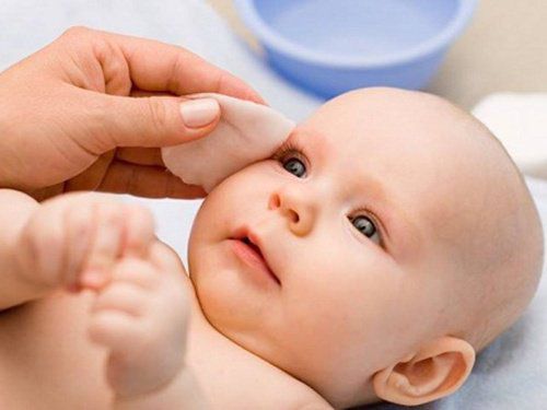 tắc lệ đạo ở trẻ sơ sinh