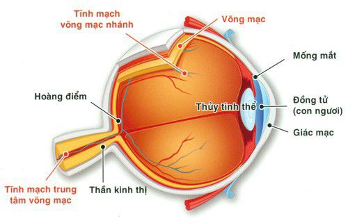 tắc tĩnh mạch võng mạc