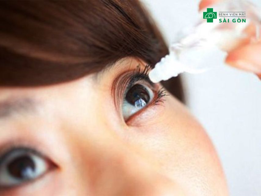 Thuốc nhỏ mắt giúp mắt không bị khô.