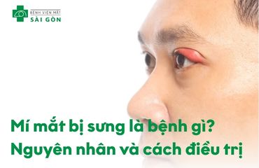 Tổng quan chung tình trạng mí mắt bị sưng
