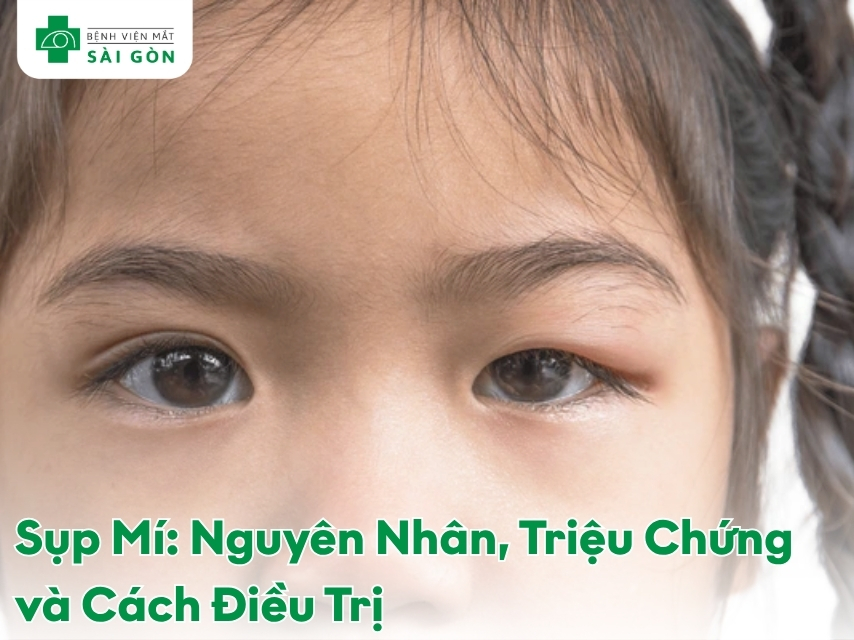 Tổng quan chung về bệnh sụp mí mắt