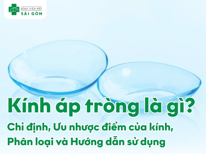 Nhận biết kính áp tròng và các thông tin nên biết