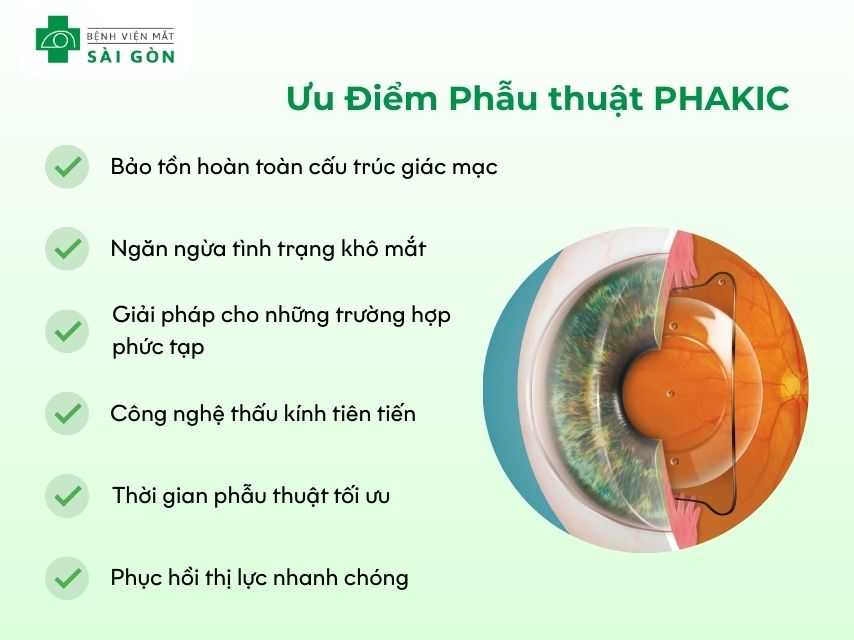 PHAKIC phù hợp cận cao