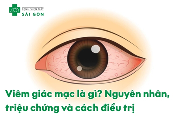 Viêm giác mạc gây đau nhức, đỏ mắt, chảy nước mắt, giảm thị lực