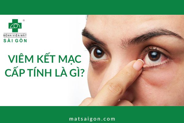 viêm kết mạc cấp tính